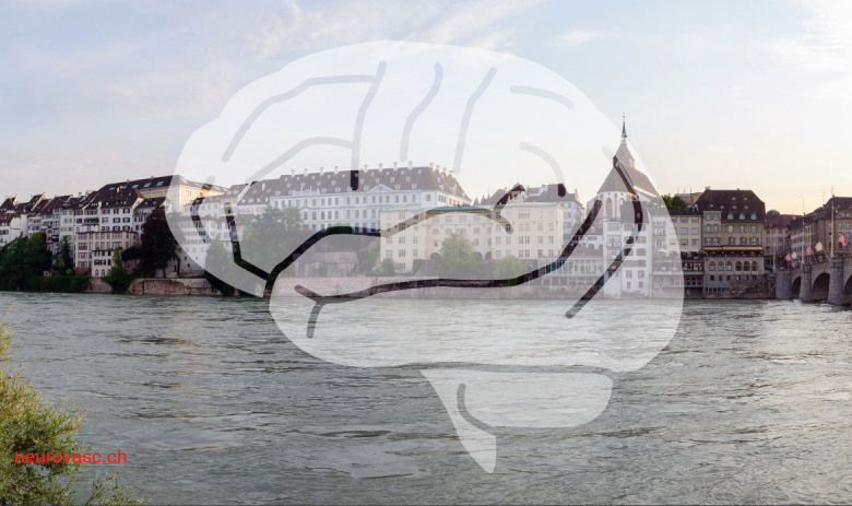 Fachtagung Hirnschlag Eine Stadt am Wasser. Transparent über die Mitte des Bildes gelegt ist eine Illustration eines Gehirns